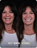 Two women smiling side by side